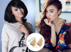 Lan Ngọc chia sẻ về hành trình thăng hạng nhan sắc
