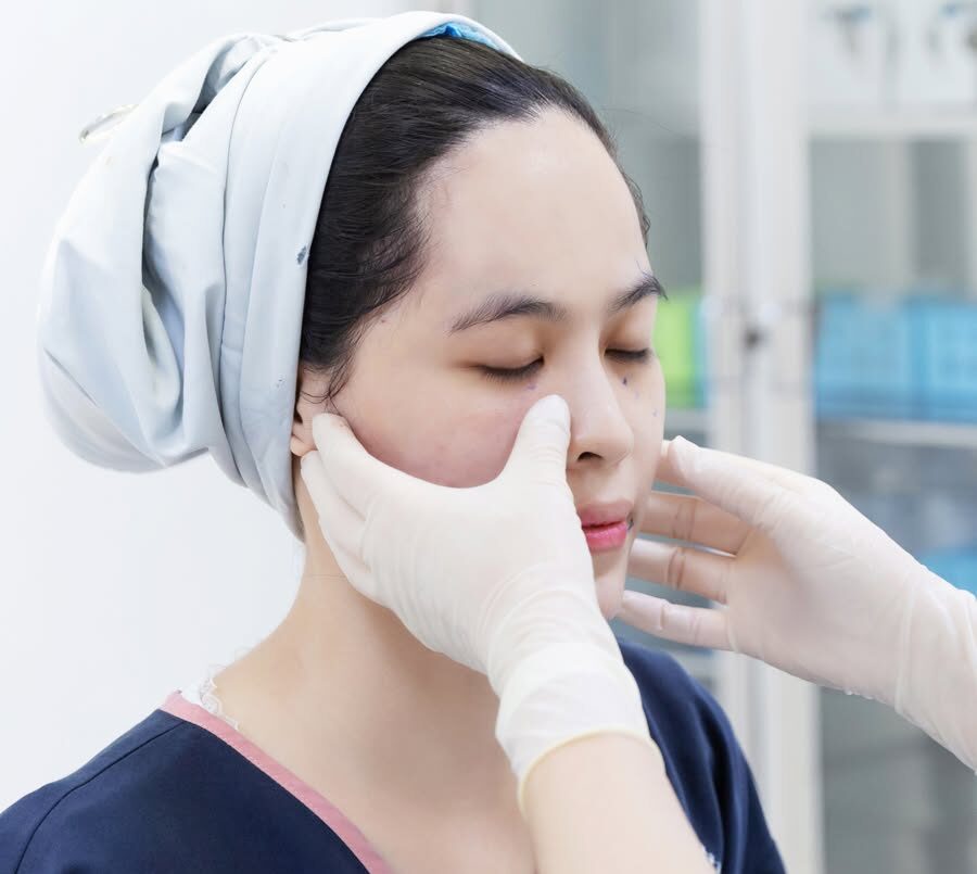 Phẫu thuật thu gọn cánh mũi