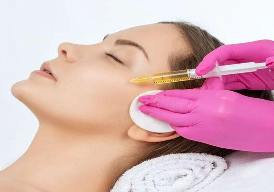 Vampire Facelift – Trẻ hoá da mặt
