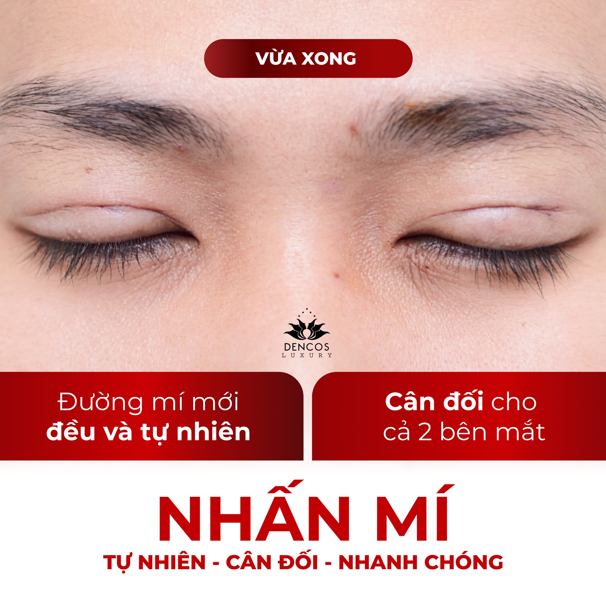 QUÁ TRÌNH LÀNH THƯƠNG VÀ CÁC BIỂU HIỆN SINH LÝ BÌNH THƯỜNG