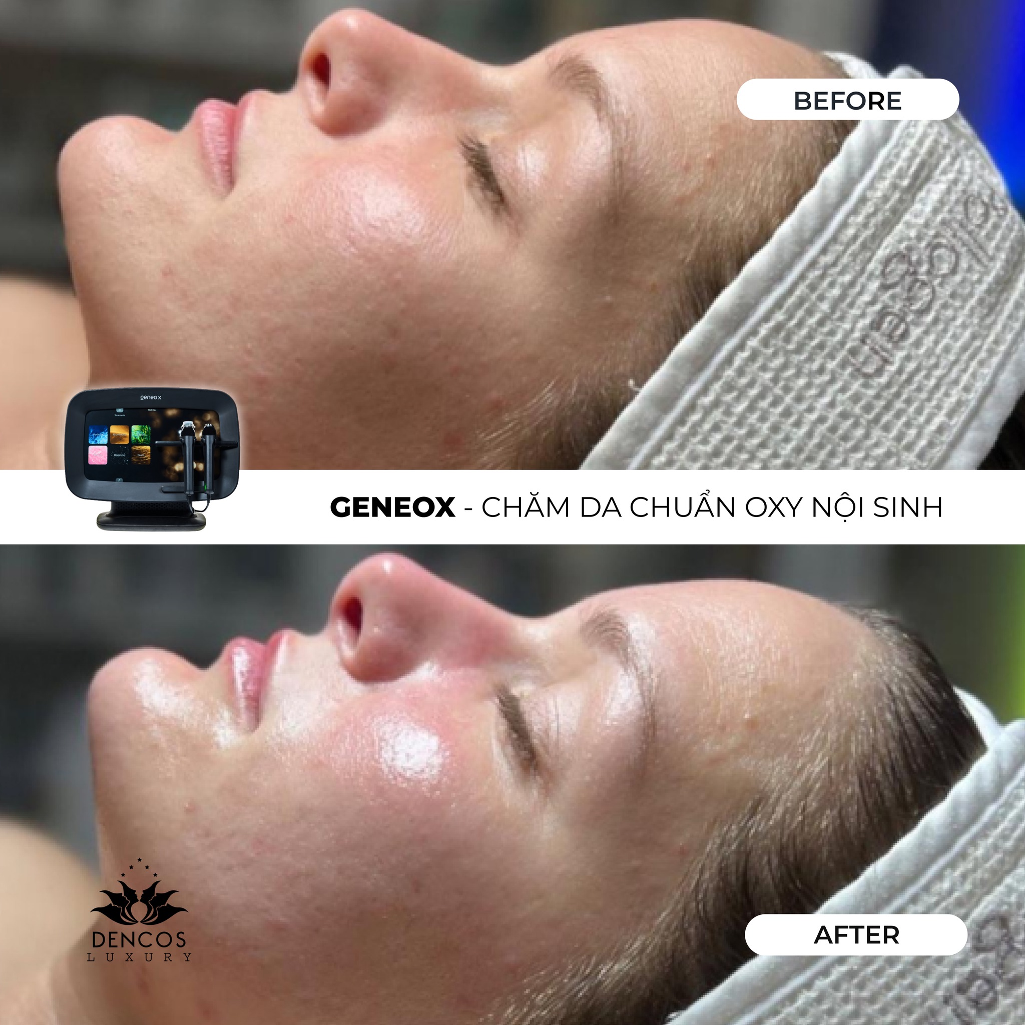 GeneoX cùng Oxy Nội Sinh: Chìa Khóa "Hồi Sinh" Da Từ Gốc