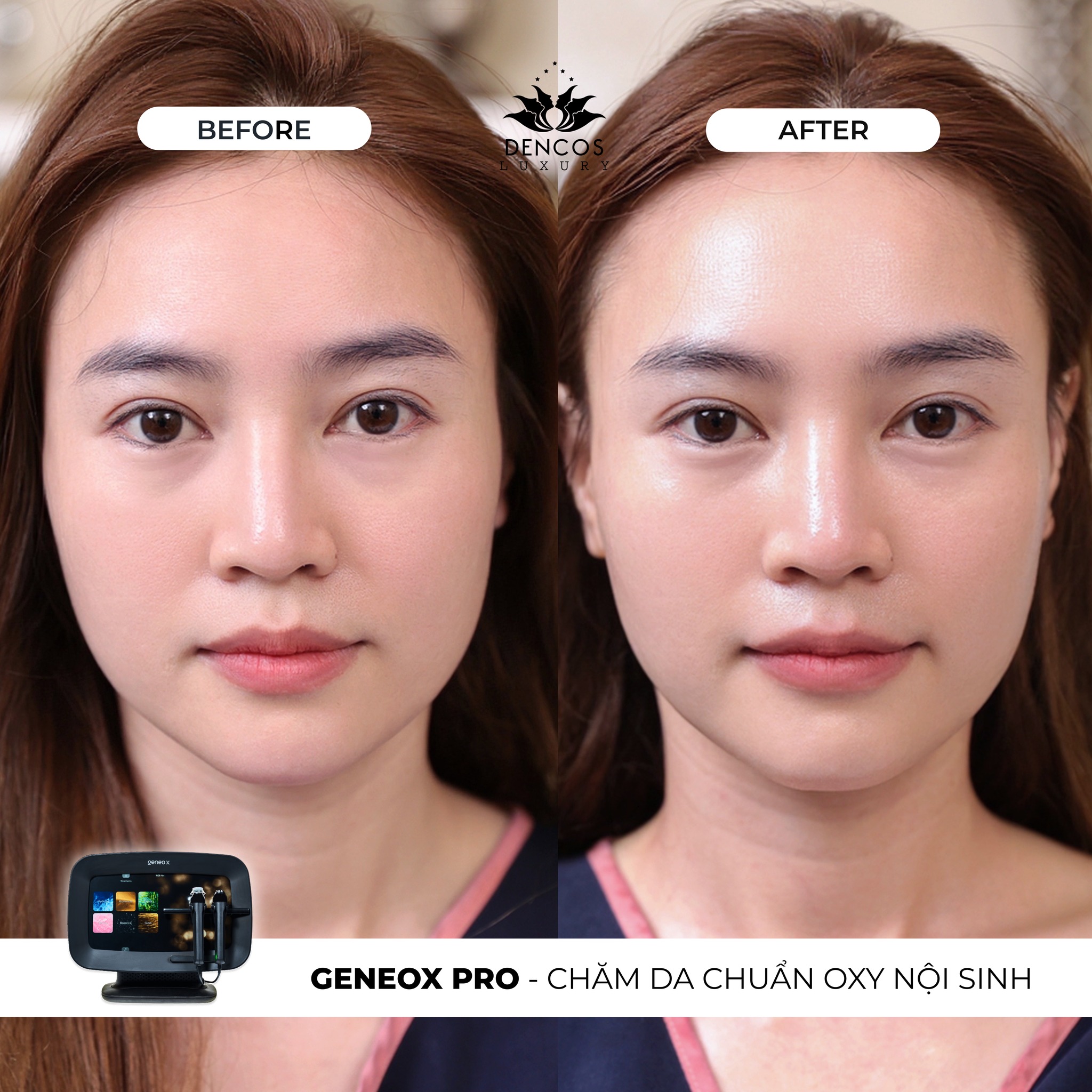 Ai phù hợp với GeneoX