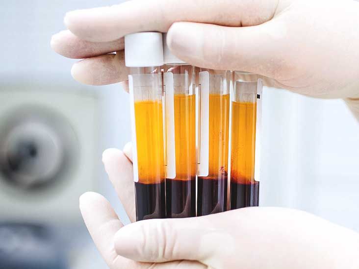 PHỤC HỒI TRẺ HÓA TẾ BÀO BẰNG PHƯƠNG PHÁP PRP: KÍCH HOẠT QUY TRÌNH TÁI SINH TỰ NHIÊN