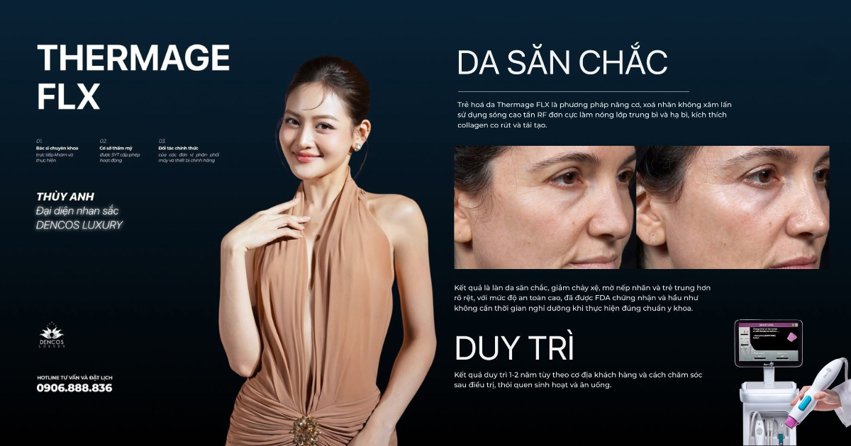 THERMAGE FLX TẠI DENCOS LUXURY: ĐỈNH CAO LÀM PHẢNG NẾP NHĂN, TÁI SINH NỀN DA MỊN MÀNG