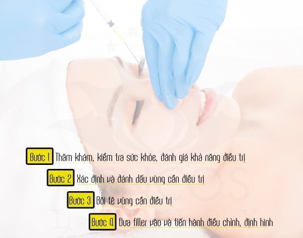 Quy trình điều trị cơ bản bằng filler.